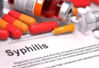 Sifilis xəstələrinin bölgələr üzrə sayı açıqlandı - STATİSTİKA
