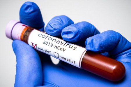 İranda daha 406 nəfər koronavirusdan öldü