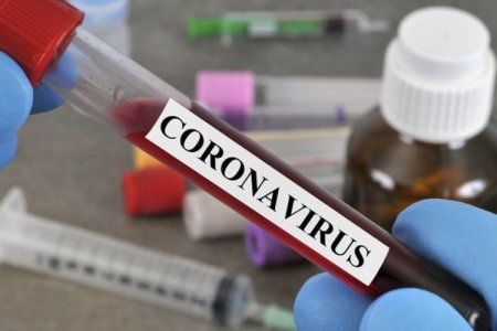 Rusiyada son sutkada 11 534 nəfər koronavirusa yoluxub