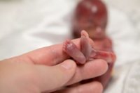 Azərbaycanda abort edən qadınların sayı azalıb