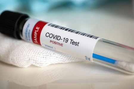 Koronavirus statistikası: 47 nəfər sağaldı, 122 nəfər yoluxdu, ölən yoxdurdü