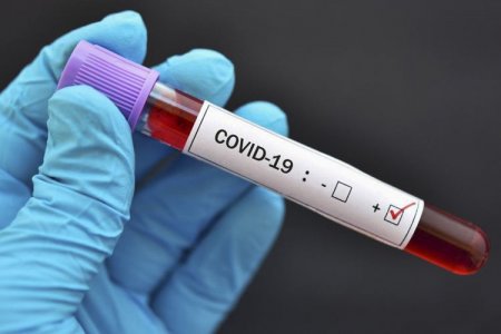 İranda son sutkada koronavirusdan 486 nəfər ölüb